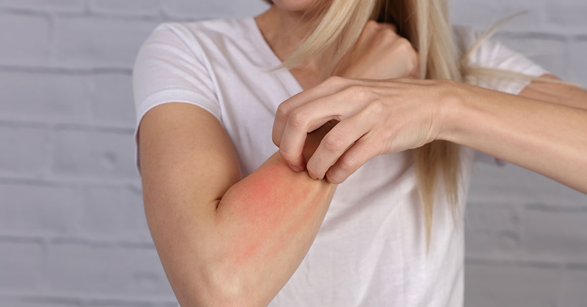 ER of Texas has top-rated emergency rooms in the DFW area that would treat if you experience severe allergic reactions.