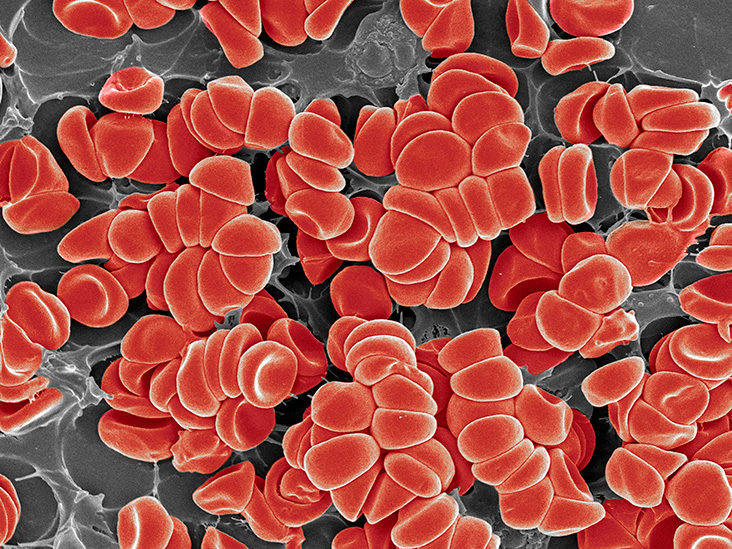 Blood Clots: Risks, Symptoms, Treatments, Prevention