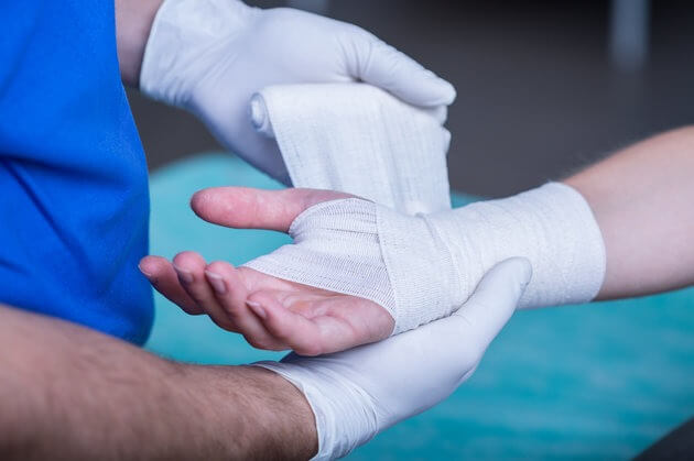 Burn Symptoms and Emergency Room (ER) Treatment