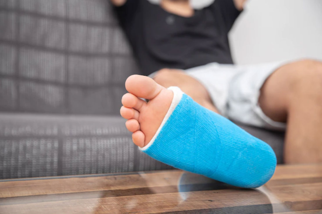 Sprain vs. Fracture — What’s the difference?