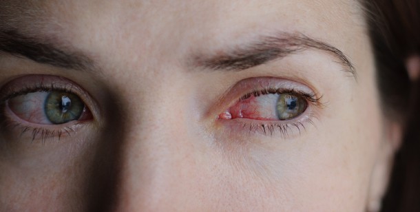 When is eye twitching a sign of a stroke, and how do you know when to go to the doctor? Keep reading for everything you need to know.