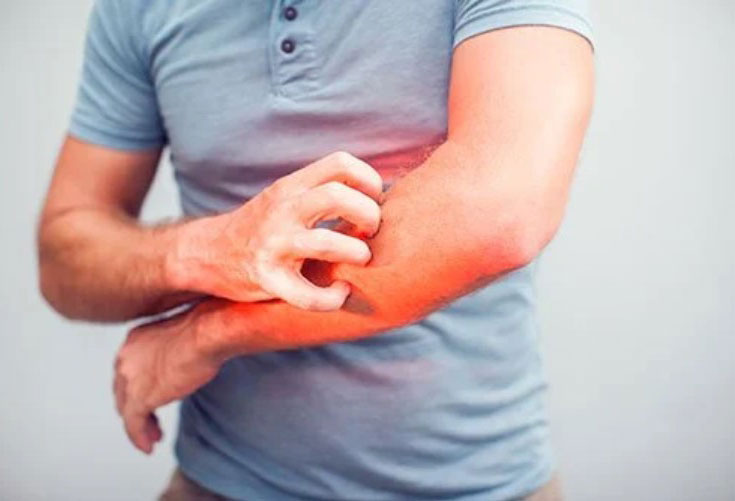 When to Visit Emergency Room for Skin Rash