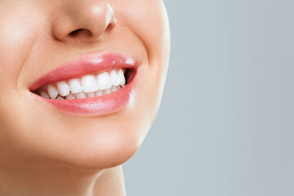 simple home remedies to whiten your teeth naturally
